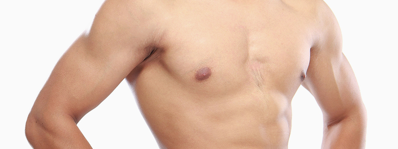 Redução das Mamas no Homens (Ginecomastia) em Porto Alegre - Dr. F. Felipe Laitano - Cirurgia Plástica